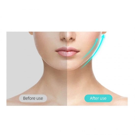 Συσκευή lifting προσώπου Skinny face
